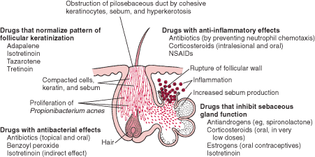 to eliminate cystic acne doctor with drug to eliminate cystic acne doctor with drug